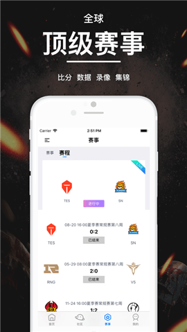 羺ٷ